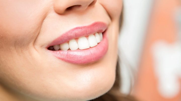 3 Benefits to Cosmetic Dentistry